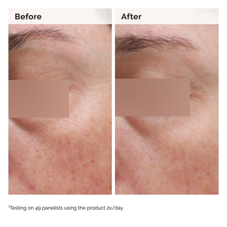niacinamide-5-face-and-body-emulsion-w2 2024-08-23-ORD-Nia-5pct-Face-Body-B-A-Elasticity-Global-02-1x1.jpg