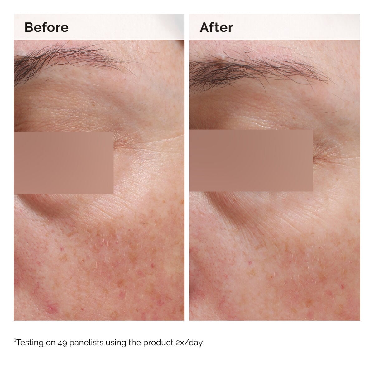 niacinamide-5-face-and-body-emulsion-w2 2024-08-23-ORD-Nia-5pct-Face-Body-B-A-Elasticity-Global-02-1x1.jpg