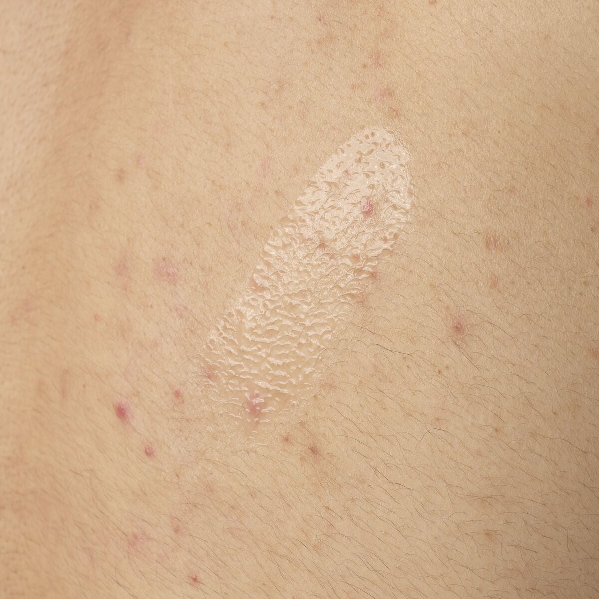 salicylic-acid-0-5-body-serum-o8 ORD-salicylic-acid-05-body-240ml-application.jpg