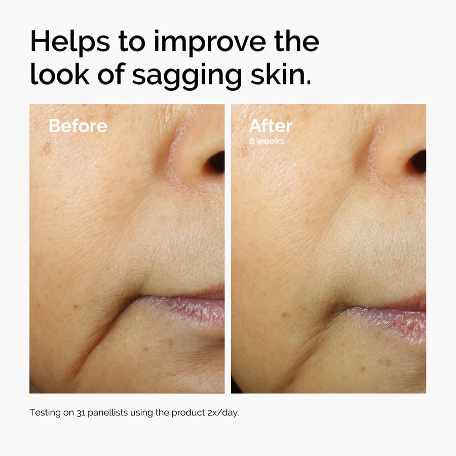 caffeine-3-escin-1-face-serum-y0 ord-caffeine-3pct-escin-1pct-face-serum-before-after-sagging.jpg