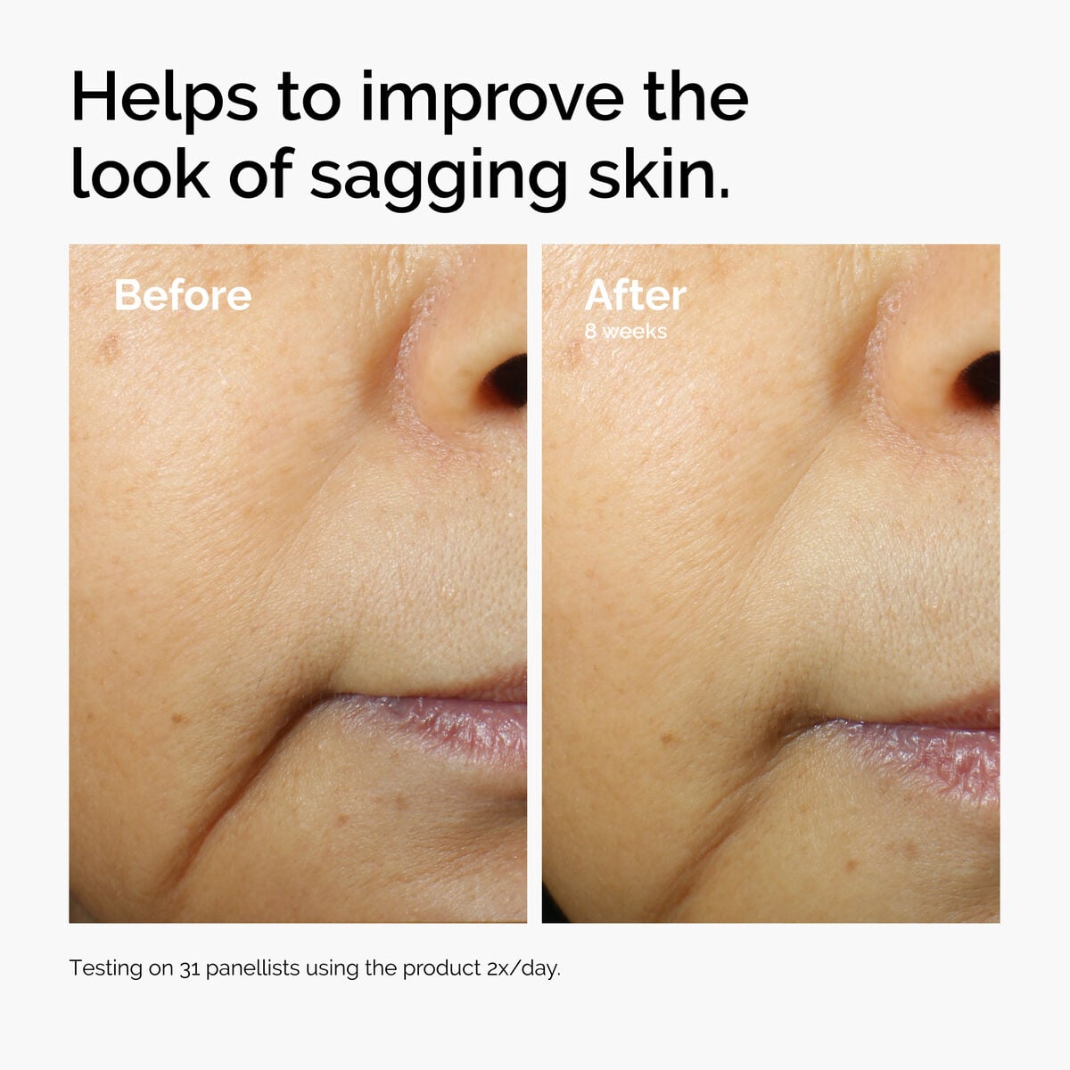 caffeine-3-escin-1-face-serum-y0 ord-caffeine-3pct-escin-1pct-face-serum-before-after-sagging.jpg