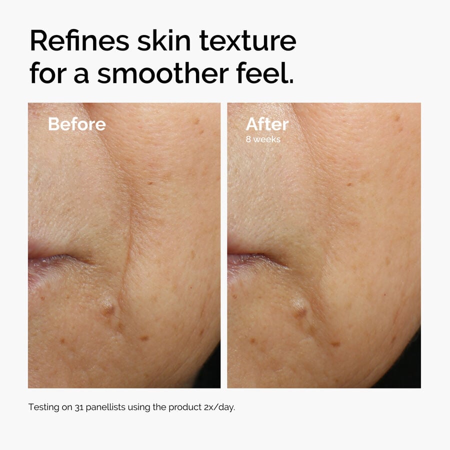 caffeine-3-escin-1-face-serum-y0 ord-caffeine-3pct-escin-1pct-face-serum-before-after-texture.jpg