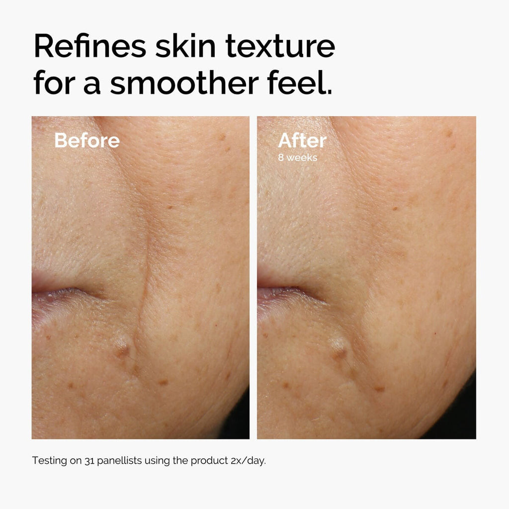 caffeine-3-escin-1-face-serum-y0 ord-caffeine-3pct-escin-1pct-face-serum-before-after-texture.jpg