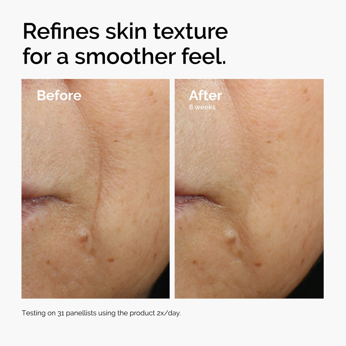 caffeine-3-escin-1-face-serum-y0 ord-caffeine-3pct-escin-1pct-face-serum-before-after-texture.jpg