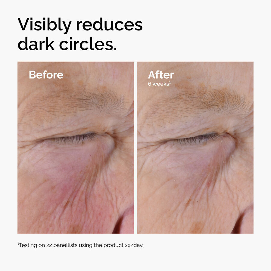 caffeine-solution-5-egcg-eye-serum-k1 ord-caffeine-solution-egcg-dark-circles-before-after.jpg