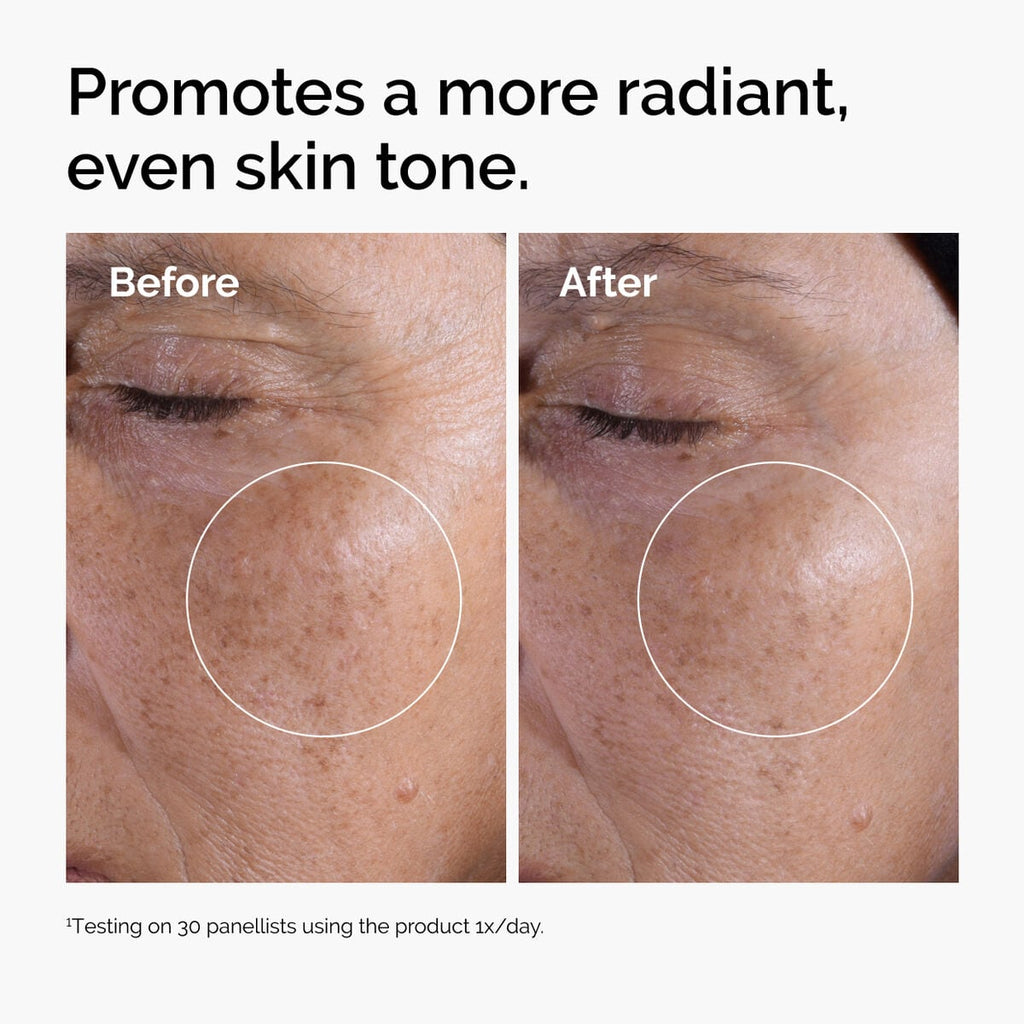 glycolic-acid-7-exfoliating-toner-j2 ord-glycolic-before-after-radiance.jpg