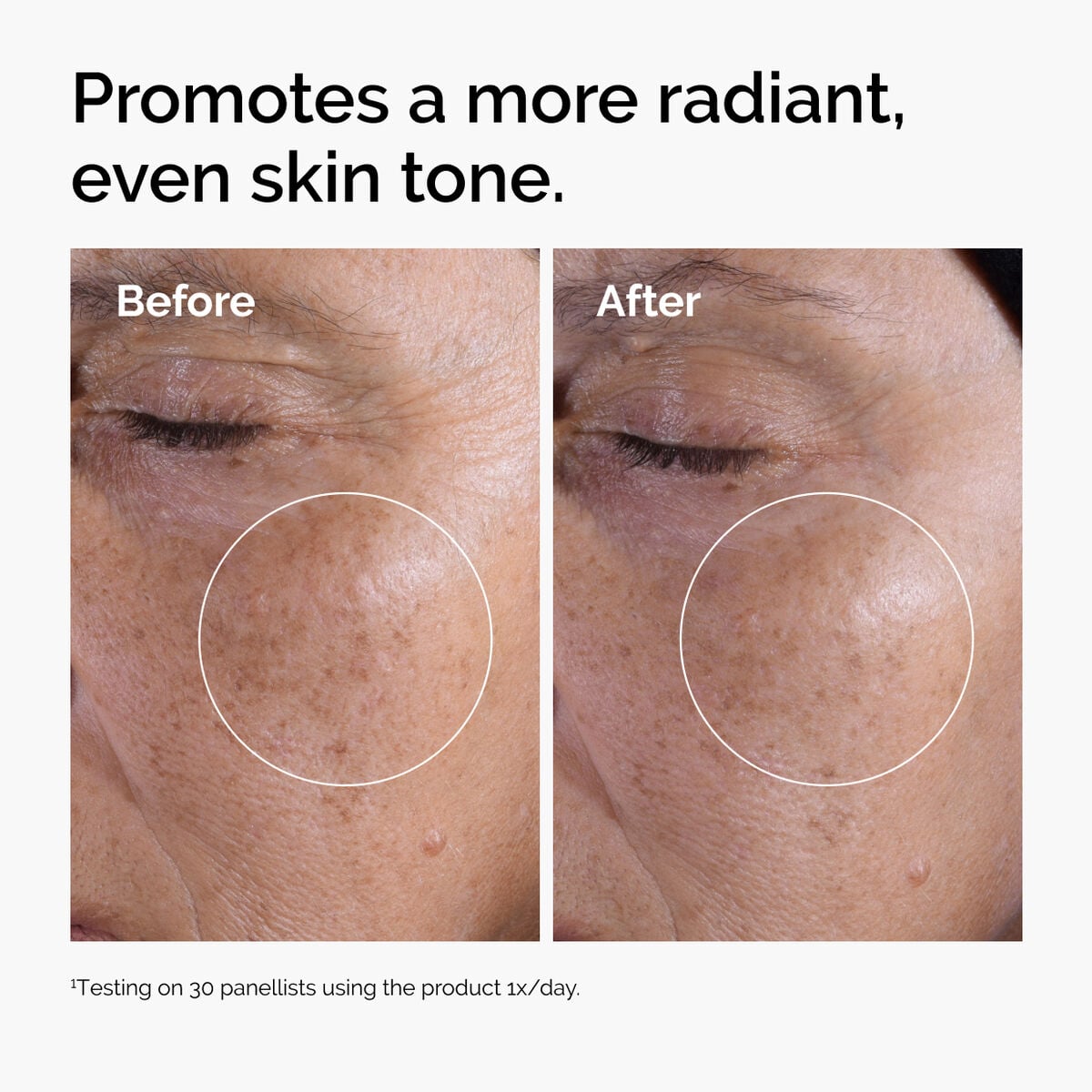 glycolic-acid-7-exfoliating-toner-j2 ord-glycolic-before-after-radiance.jpg