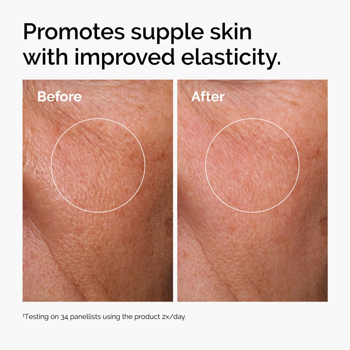 hyaluronic-acid-2-b5-with-ceramides-j1 ord-hyaluronic-acid-2pct-b5-hydrating-serum-before-after-elasticity.jpg