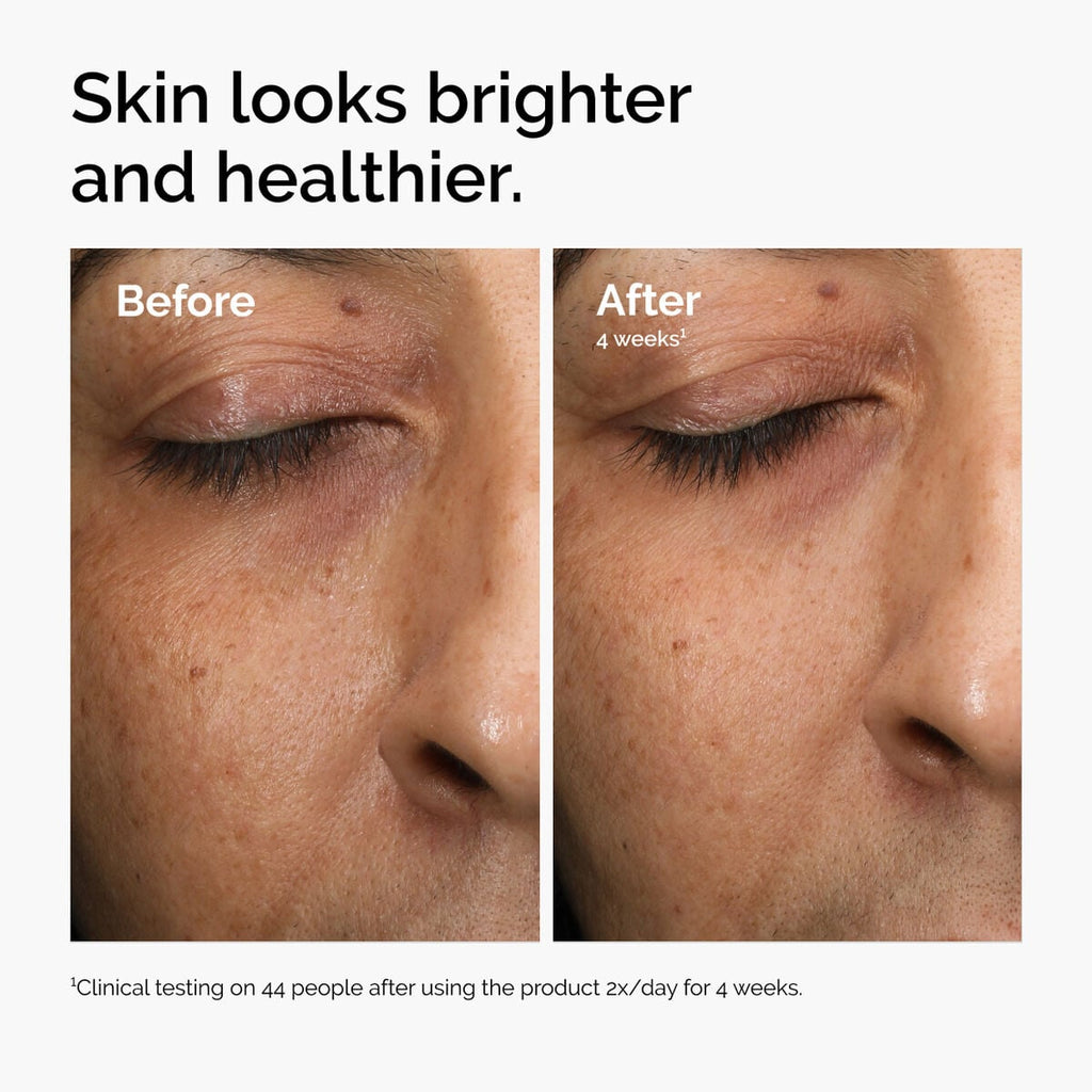 multi-antioxidant-radiance-serum-w7 ord-mars-before-after-healthy.jpg