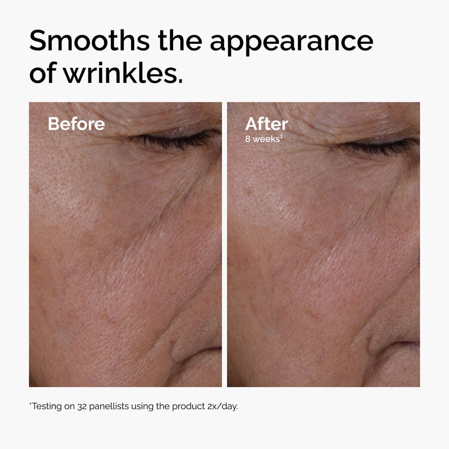 multi-peptide-ha-serum-c5 ord-multi-peptide-ha-serum-wrinkles-before-after.jpg