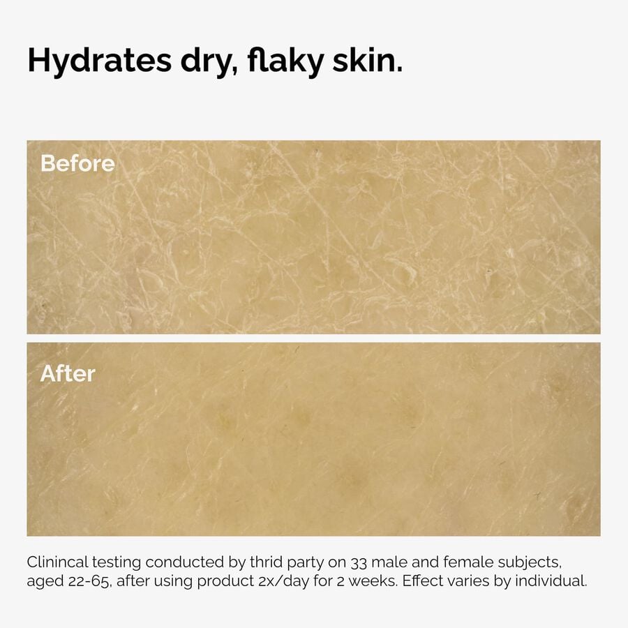 the-body-care-collection-o2 ord-natural-moisturizing-factors-inulin-body-before-after-graphic-02.jpg
