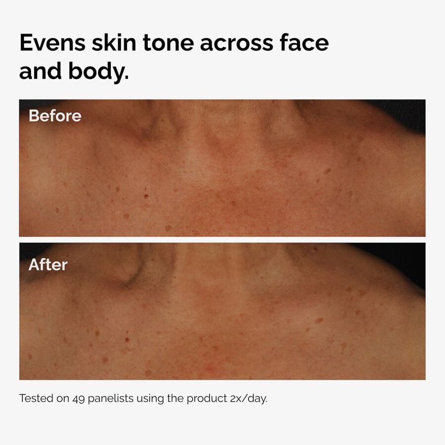 the-body-care-collection-o2 ord-niacinamide-face-body-serum-before-after-even-tone-graphic.jpg