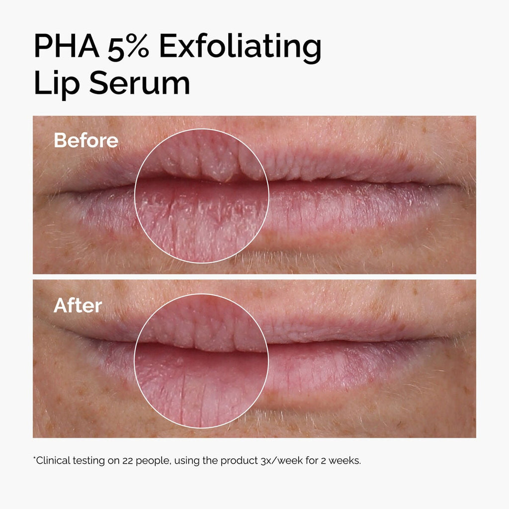 pha-5-exfoliating-lip-serum-a0 ord-pha-5pct-lip-exfoliating-serum-before-after.jpg