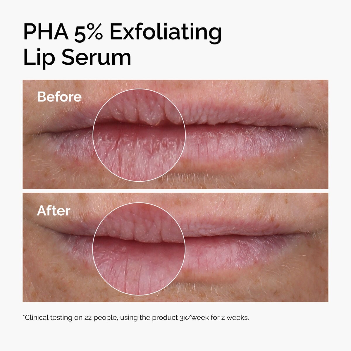 pha-5-exfoliating-lip-serum-a0 ord-pha-5pct-lip-exfoliating-serum-before-after.jpg