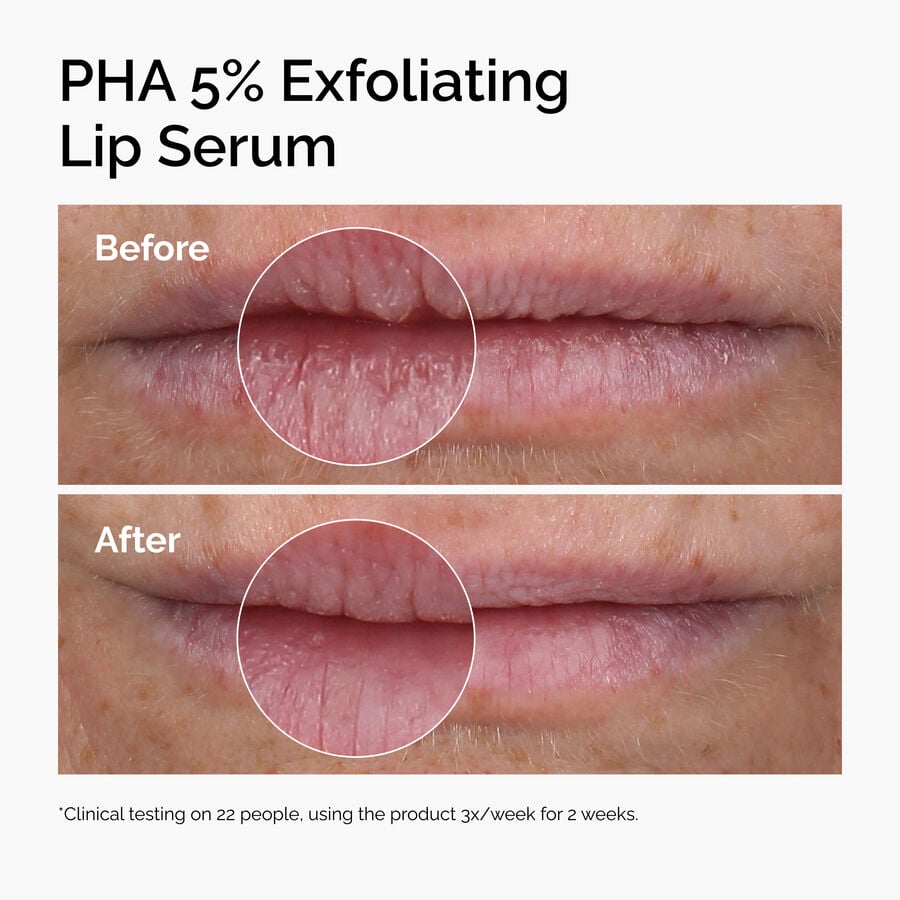 pha-5-exfoliating-lip-serum-a0 ord-pha-5pct-lip-exfoliating-serum-before-after.jpg