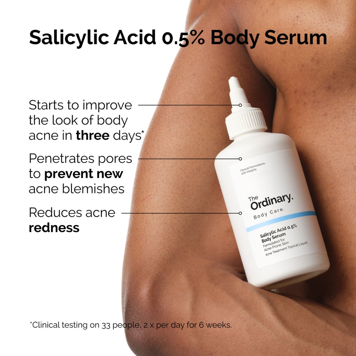 salicylic-acid-0-5-body-serum-o8 ord-salicylic-05-body-serum-otc-benefits-infographic.jpg
