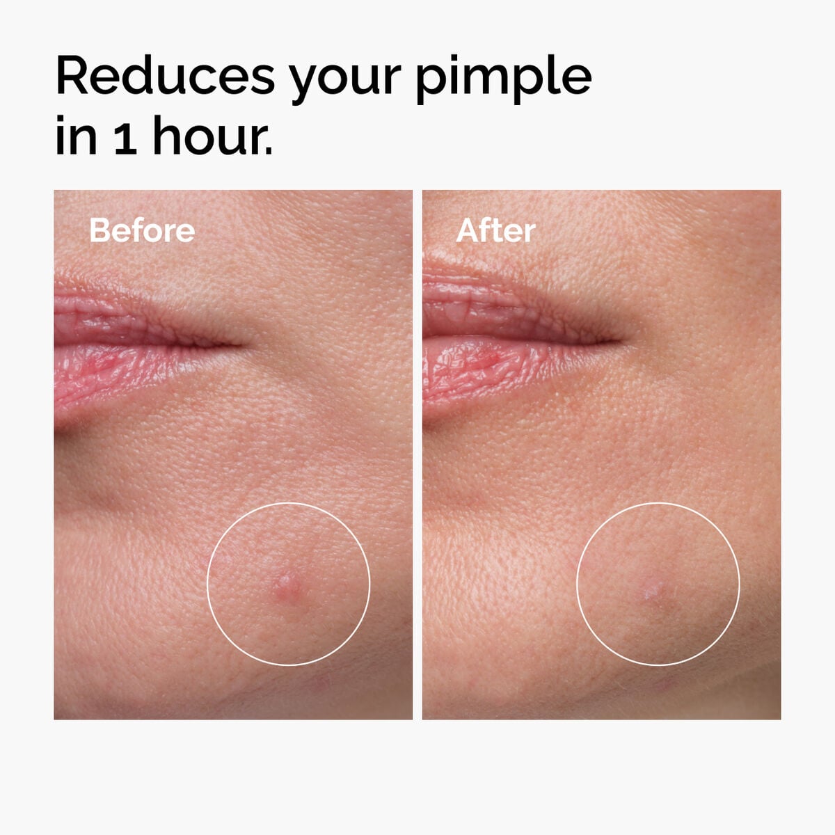 sulfur-10-powder-to-cream-concentrate-j5 ord-sulfur-10pct-powder-to-cream-concentrate-before-after-NA.jpg